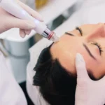 Non-Surgical Facial Rejuvenation: 5 Remarkable Ways to Look Years Younger